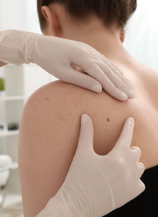dermatology